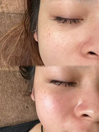 Nalu所属・まつ毛パーマ／脱毛 Naluのエステ・リラクイメージ