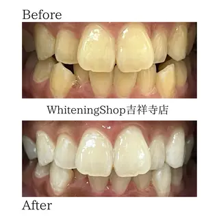 ホワイトニング ショップ吉祥寺店のエステ・リラクイメージ