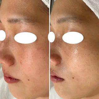 中澤 夢華のエステ・リラクイメージ