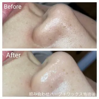 深い肌悩み専門 フェイシャルサロンのエステ・リラクイメージ