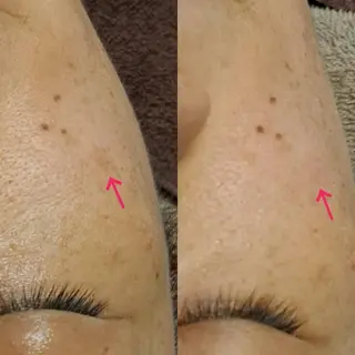 LiZA エステティックサロンのエステ・リラクイメージ