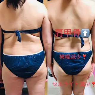 首・肩こり専門リンパ ケアサロンSENKAのエステ・リラクイメージ