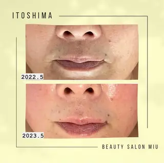 糸島 エステサロンmiuのエステ・リラクイメージ