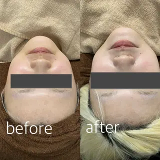 kitamura yuiのマツエク・マツパデザイン