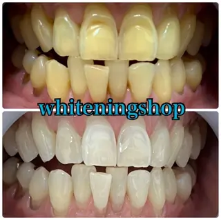 ホワイトニング ショップ吉祥寺店のエステ・リラクイメージ