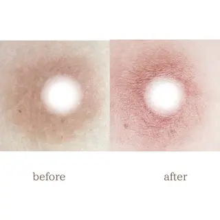 小顔専門看護師クリニカルサロンCOCO所属・小顔と美肌サロン クリニカルサロンココのエステ・リラクイメージ