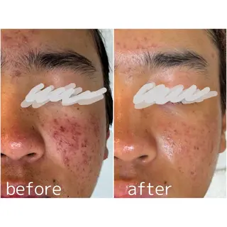 For...天王寺店 リンパ|ヘッドよもぎのエステ・リラクイメージ