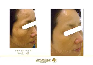 肌質改善サロン renew所属・肌質改善サロン renew/ｳｴｷのエステ・リラクイメージ