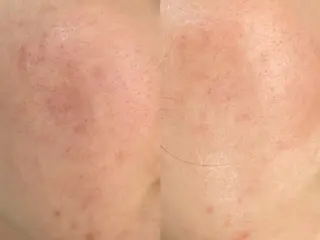 private salon éclat所属・ニキビ・毛穴専門 éclat/エクラのエステ・リラクイメージ