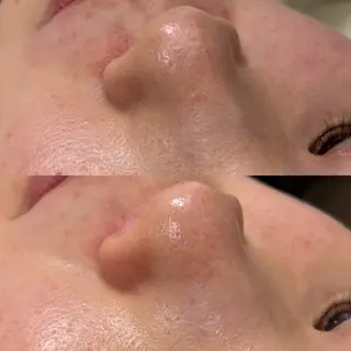 毛穴と脱毛のお店 "Lea" 壷林のエステ・リラクイメージ