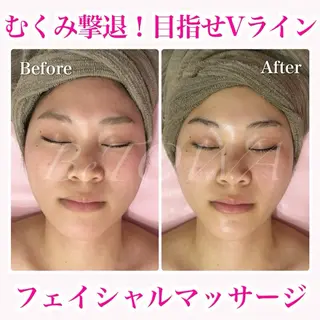 BeTOWA所属・BeTOWA 毛穴洗浄/Wax脱毛のエステ・リラクイメージ