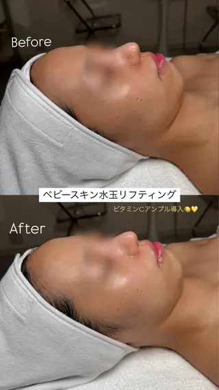 韓国肌管理🫧LDM 🫧Junnaのエステ・リラクイメージ