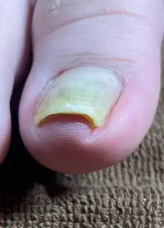 ネイル door  froh chikakoのネイルデザイン