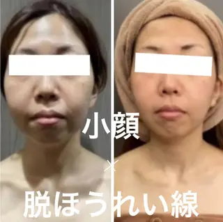 レイビス 渋谷店🩵のエステ・リラクイメージ