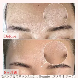 毛穴ケア専門サロン Amélio Beauté所属・毛穴ケア専門サロン アメリオボーテのその他イメージ