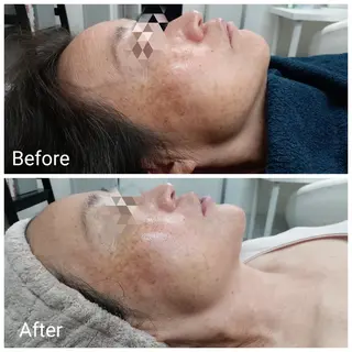 肌質改善Beauty salon Renのエステ・リラクイメージ