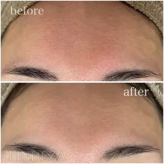 private salon 𝐋𝐈𝐍𝐃𝐄𝐙𝐀所属・LINDEZA Ayaのエステ・リラクイメージ