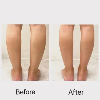 salon ray 痩身／体質改善のエステ・リラクイメージ