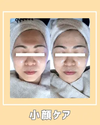 |ピーリング・毛穴| soina神楽坂のエステ・リラクイメージ