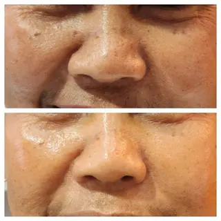 表参道鍼灸院K 美容鍼🔮ララピールのエステ・リラクイメージ