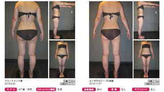 オレンジバナナ 亀貝インター店のエステ・リラクイメージ