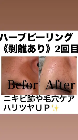 美肌管理サロン　ペルボヌール所属・韓国美肌管理サロン ペルボヌールのエステ・リラクイメージ