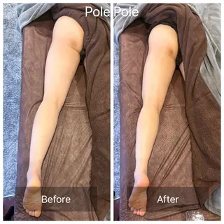 キッズ Pole Poleのエステ・リラクイメージ