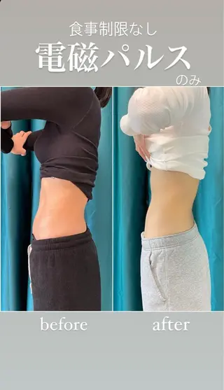 毛穴レス ハーブ＆ ワックス脱毛×光脱毛のエステ・リラクイメージ