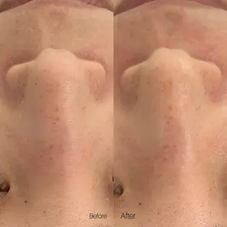 〈etre〉トータルビューティーサロン所属・etre - 韓国肌管理 -のエステ・リラクイメージ