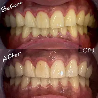 メンズ キッズ ホワイトニングサロン Ecru所属・ホワイトニングサロン Ecru エクリュのその他イメージ