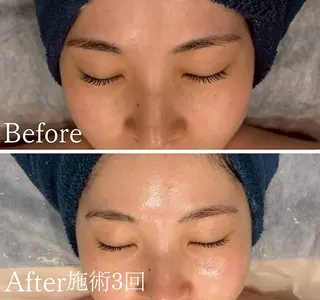 アンド ミルルのエステ・リラクイメージ