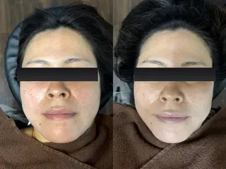 イルミナ 伊藤のエステ・リラクイメージ