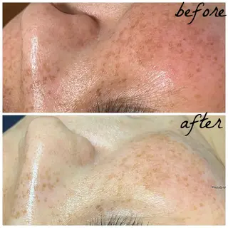 メンズ メナード岐阜市茜部 杉浦のエステ・リラクイメージ