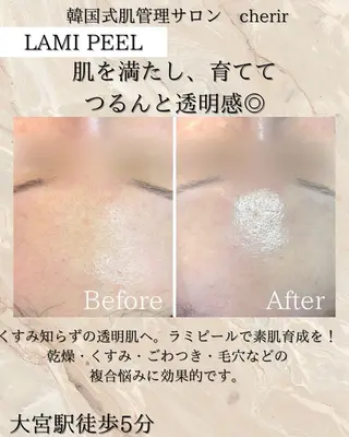 cherir所属・cherir大井町/ 毛穴ニキビ改善専門のエステ・リラクイメージ