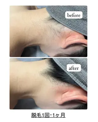 blue.【都度払い脱毛&フェイシャルサロン】所属・blue.💙【 脱毛&フェイシャル】のエステ・リラクイメージ