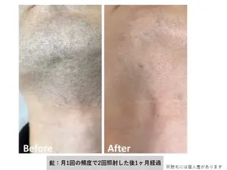 エステサロンさら所属・エステサロン さらのエステ・リラクイメージ