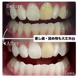 セルフ　ホワイト ニングショップ立川のその他イメージ