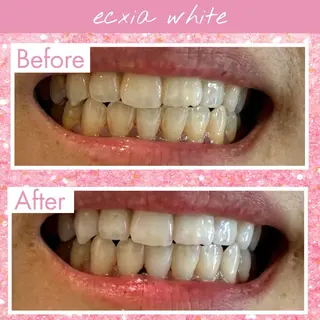 エクシアホワイト福岡六本松所属・エクシア福岡六本松 喜多のその他イメージ