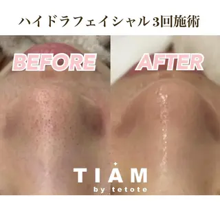 美肌サロンTIAM by tetoteのエステ・リラクイメージ