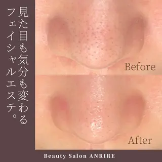 ANRIRE (アンリール)のエステ・リラクイメージ