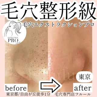 毛穴専門サロン　フルール所属・フルールFululu 自由が丘のエステ・リラクイメージ