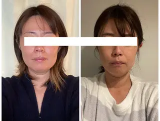 丸顔さんの救世主 高田 くみのエステ・リラクイメージ