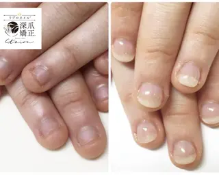 メンズ ネイル 深爪矯正専門店　ネイルサロン　トイロ所属・ネイルサロン トイロのネイルデザイン