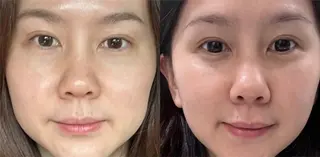 マツエク・マツパ 愛維美水光美肌専門店所属・愛維美水光美肌専門店 メンズレディースokのエステ・リラクイメージ