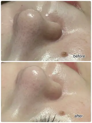 ENCHANT 脱毛.小顔.毛穴のエステ・リラクイメージ