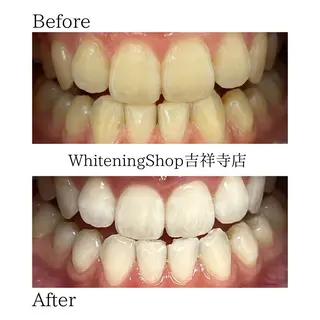 ホワイトニング ショップ吉祥寺店のエステ・リラクイメージ