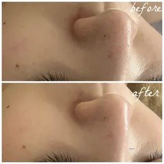 メンズ メナード岐阜茜部 杉浦のエステ・リラクイメージ