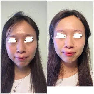 aliaハイフ&水光ジェットサロン所属・aliaハーブ水光店 エステティシャン募集のエステ・リラクイメージ