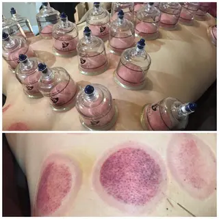 美容鍼灸女性専用 りんご鍼灸治療院のエステ・リラクイメージ