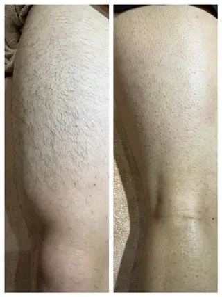 HIKARI a.k.a 神童♡のエステ・リラクイメージ